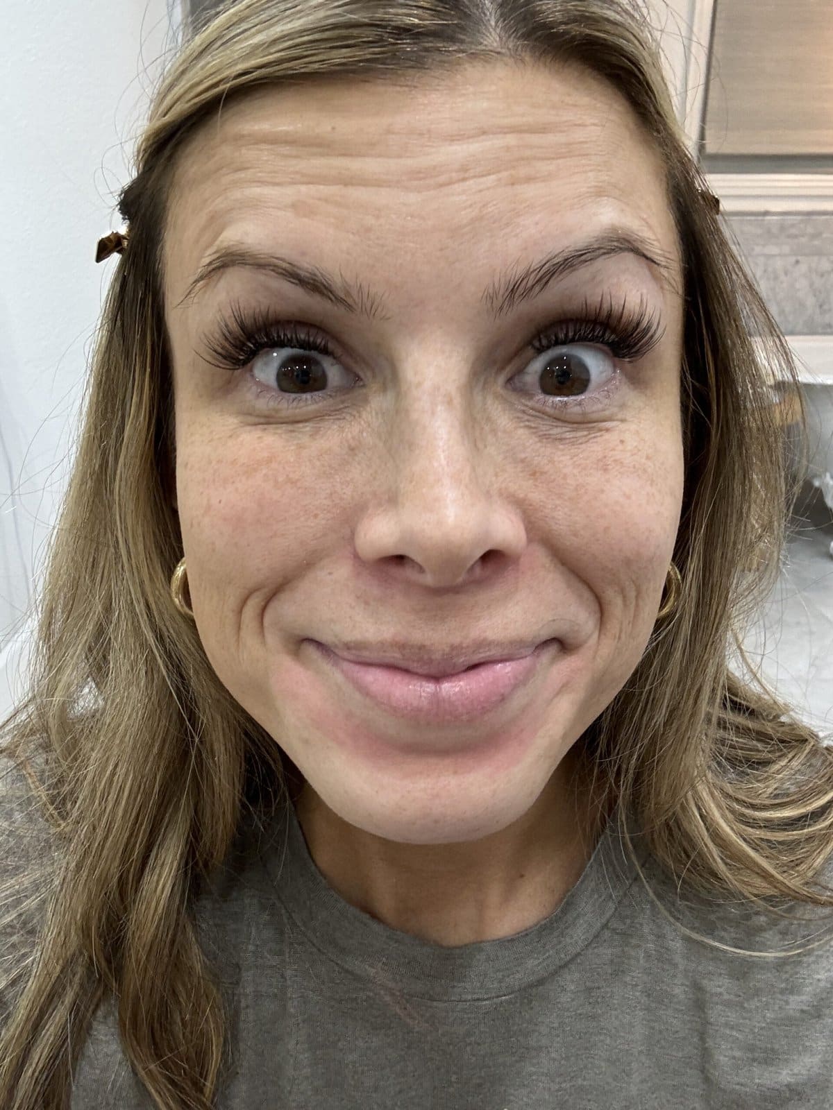 before of wrinkles